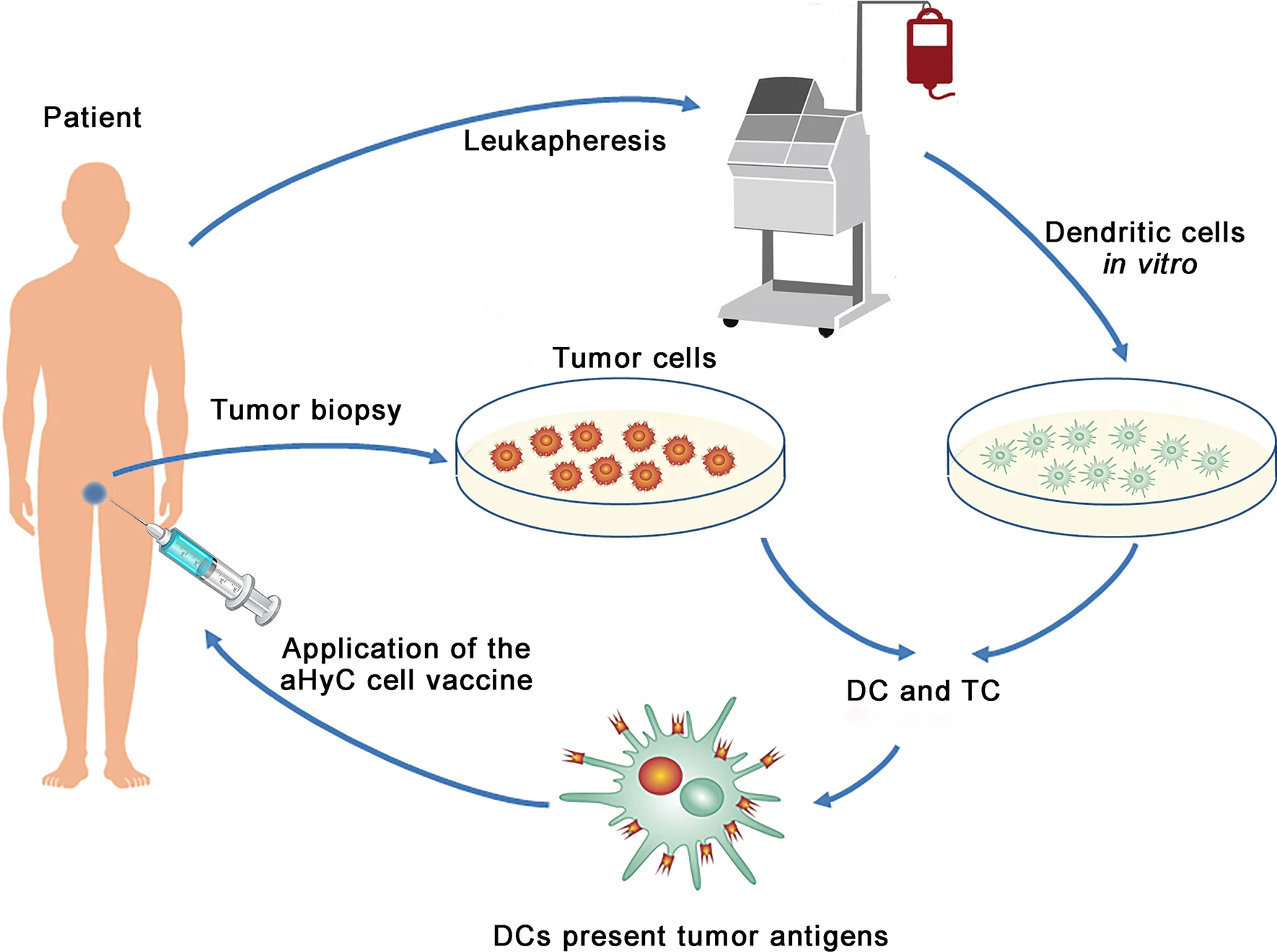 What Is Dendritic Cell Cancer Therapy?