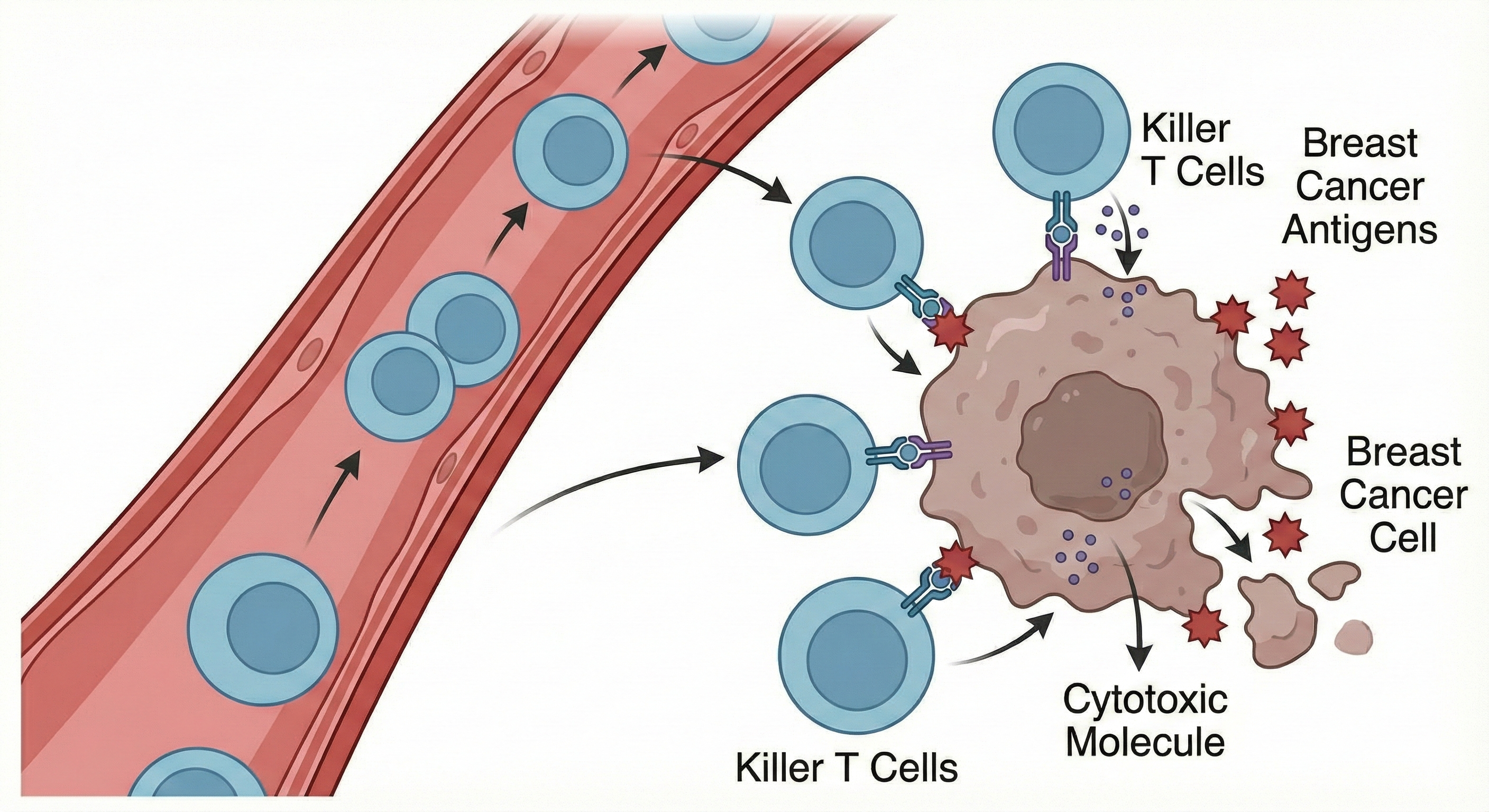 Targeting and Attacking Breast Cancer Cells