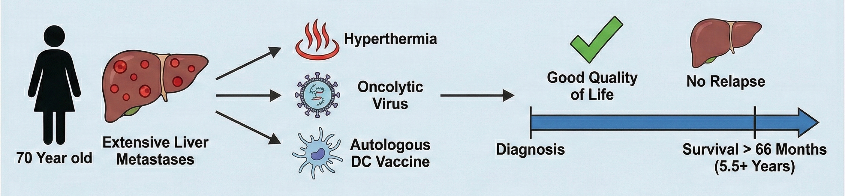 Schirrmacher & Stücker Case Report from Immun-Oncological Center Cologne about Dendritic Cell Therapy for Breast Cancer