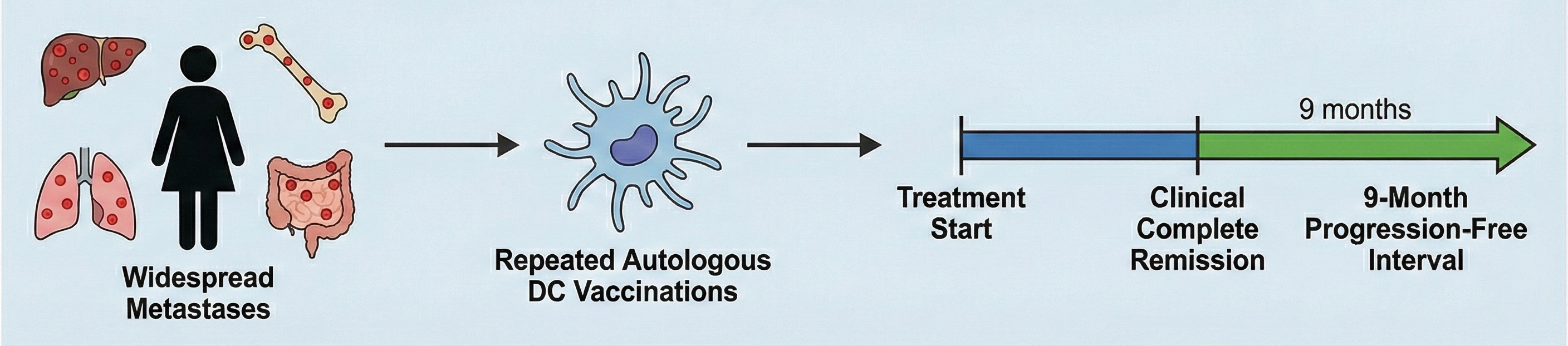 Nesselhut Case Report from Practice Group for Cell Therapy Duderstadt about Dendritic Cell Therapy for Breast Cancer