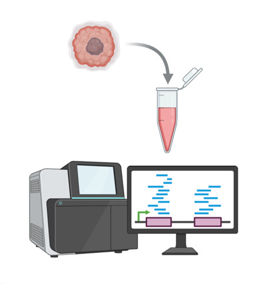Targeted Therapy for Pancreatic Cancer