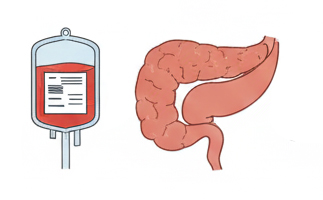 Dendritic Cell Therapy for Pancreatic Cancer