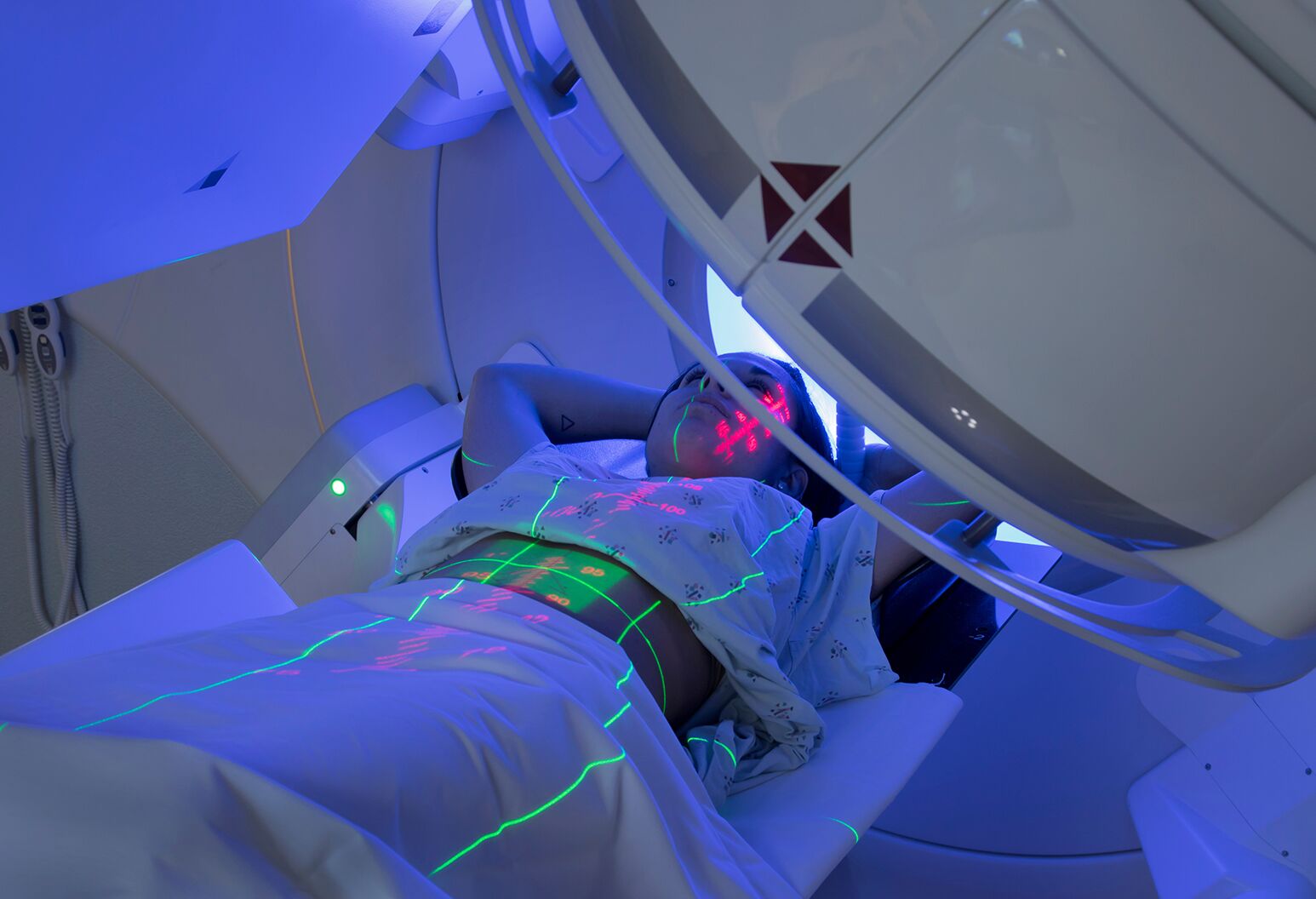 Proton Beam Therapy for Pancreatic Cancer