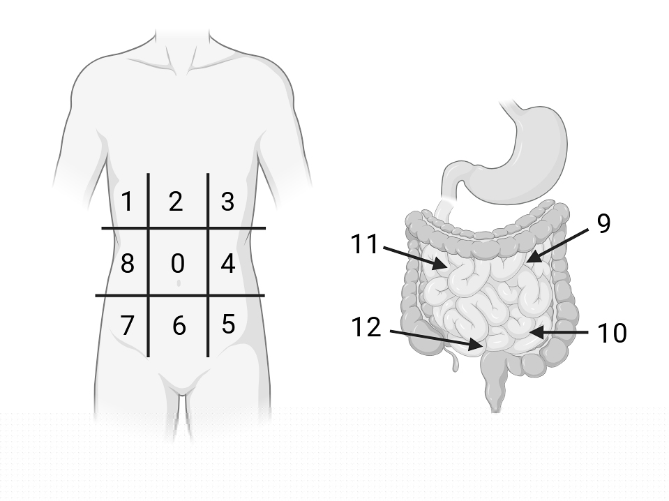 Peritoneal Cancer Index (PCI) Score