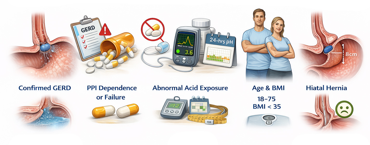 Indications for RefluxStop Surgery